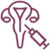 IUI (Intrauterine Insemination)