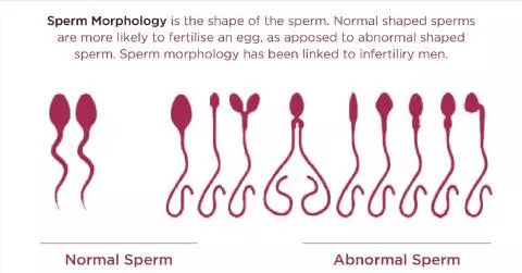 How to Read Sperm Analysis Report