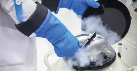  Oocyte Cryopreservation – Freezing Eggs For The Future.
