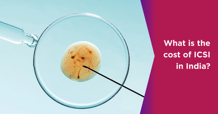 What Is the Cost of ICSI Treatment in India?