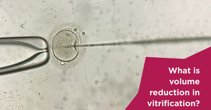 What Is Volume Reduction in Vitrification? Process and Benefits