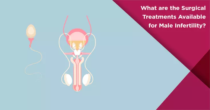 Surgical Treatments for Male Infertility: Options to Improve Fertility