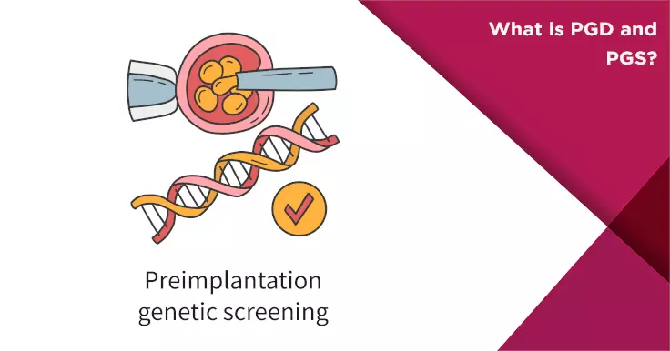 What Are PGD and PGS? Genetic Testing in Fertility Treatment
