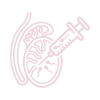 Testicular Sperm Aspiration (TESA) 