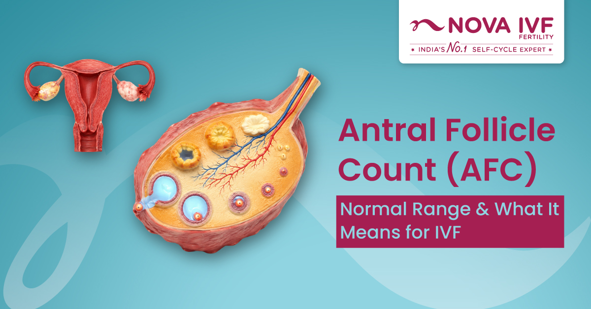 Antral Follicle Count (AFC): What Is a Normal Range, What Low AFC Means and How It Affects IVF