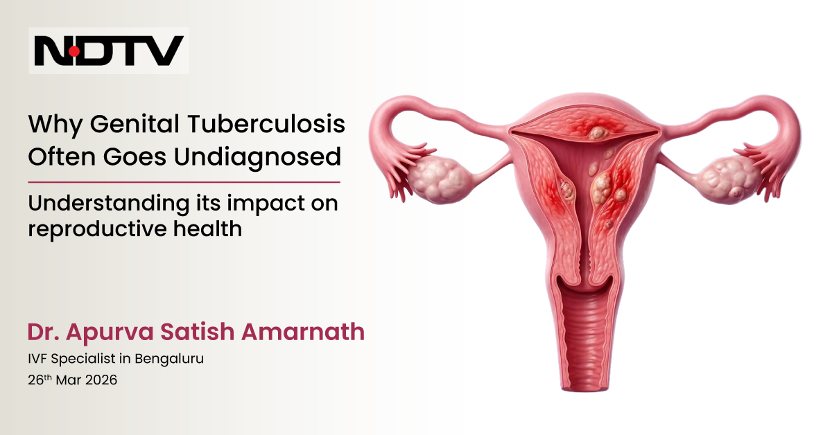Genital Tuberculosis: Is This A Hidden Cause Of Female Infertility In India?