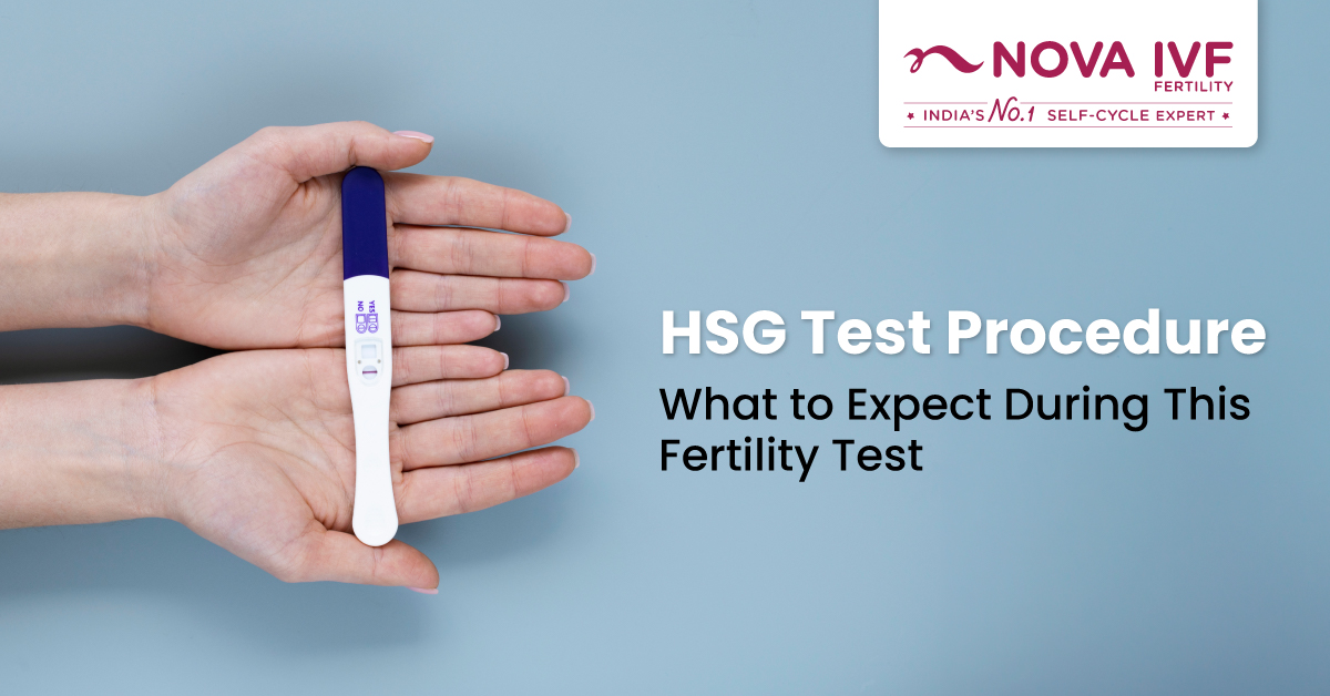 HSG Test Procedure: A Step-by-Step Guide to What Happens, How Long It Takes and What to Expect