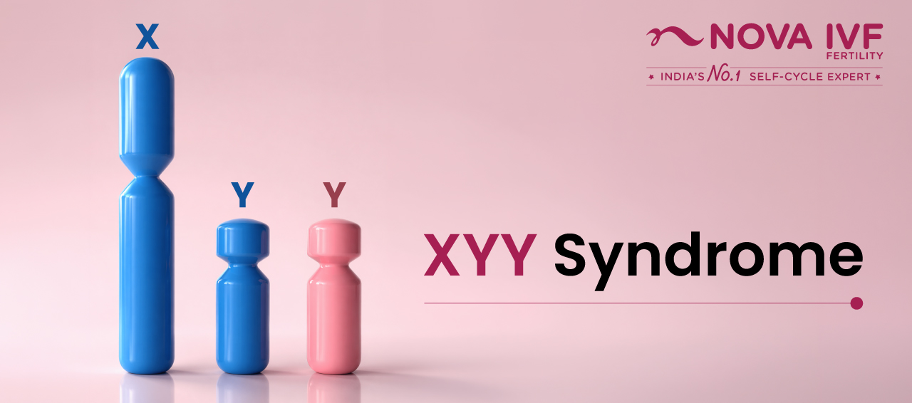 XYY Syndrome