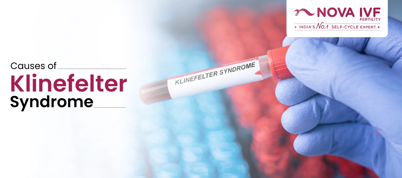 Causes of Klinefelter Syndrome