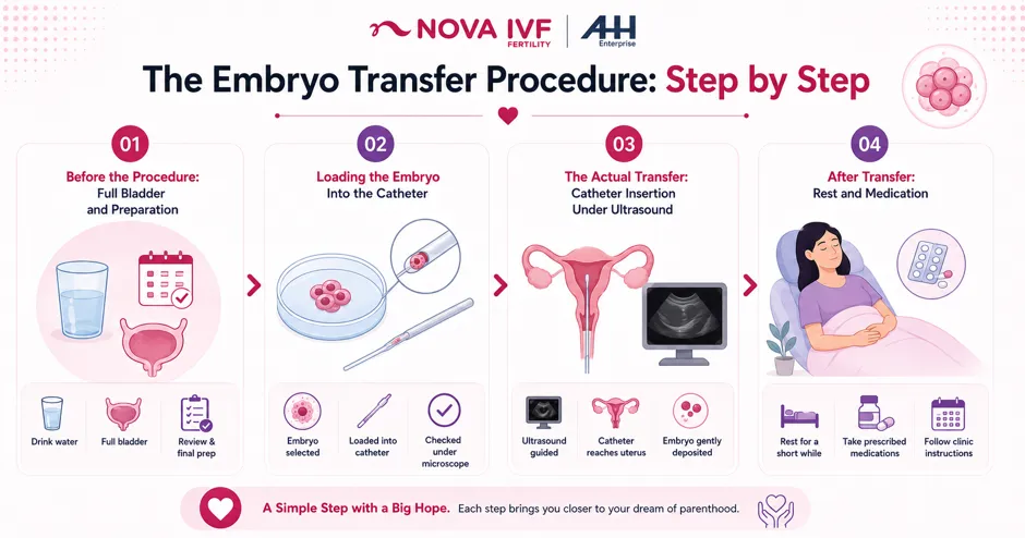 The Embryo Transfer Procedure: Step by Step