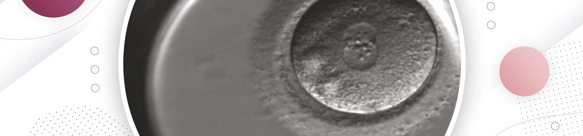 Advanced Inertility Treatment - Embryoscope