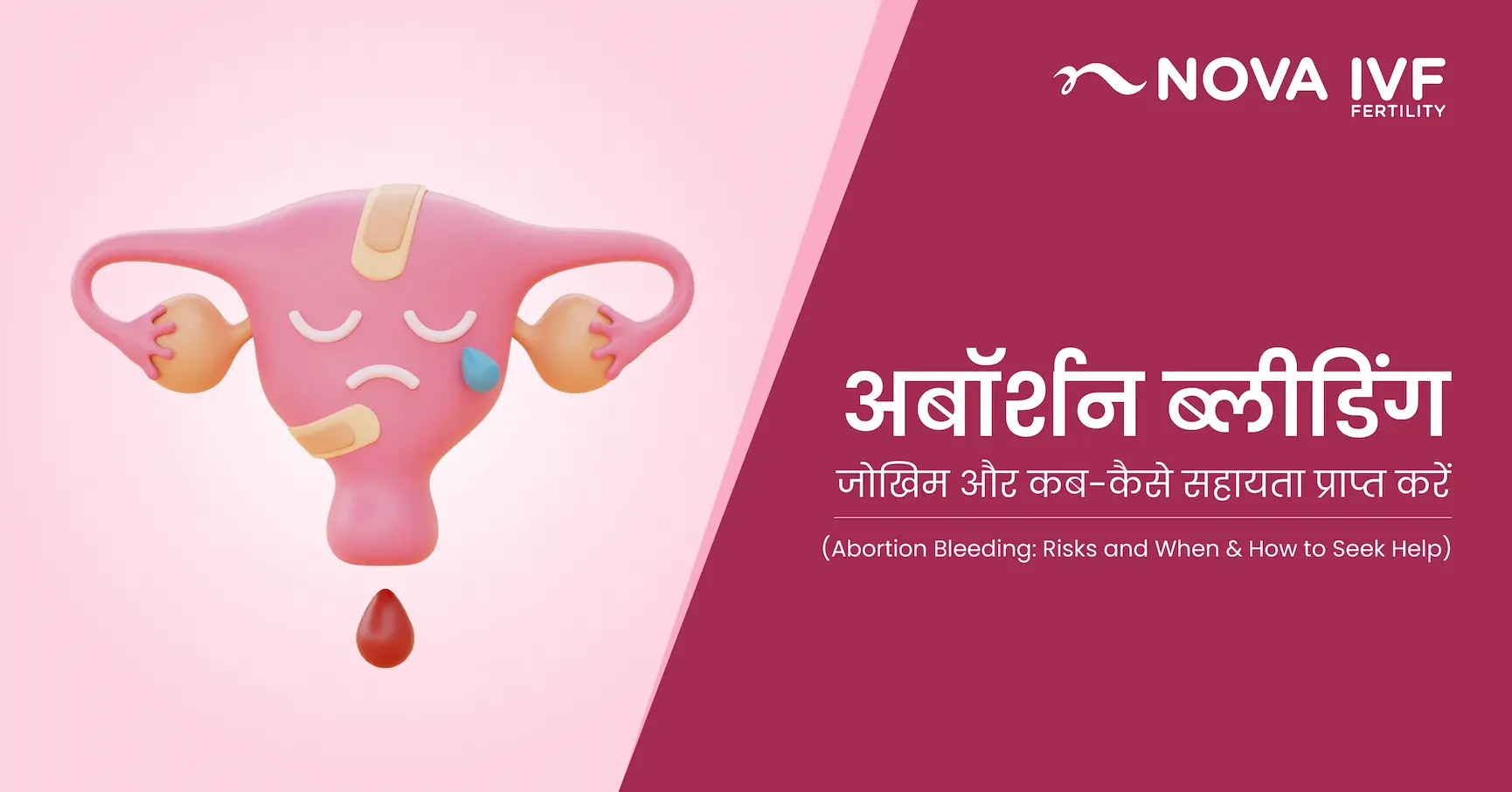 एबॉर्शन ब्लीडिंग : जोखिम और कब-कैसे सहायता प्राप्त करें (Abortion Bleeding: Risks and When & How to Seek Help) 
