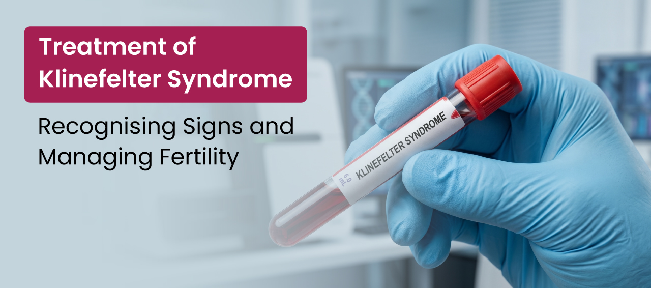  Treatment of Klinefelter Syndrome: Managing Symptoms and Improving Fertility
